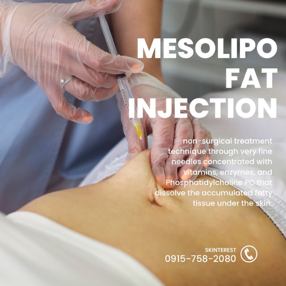 Mesolipo Treatment