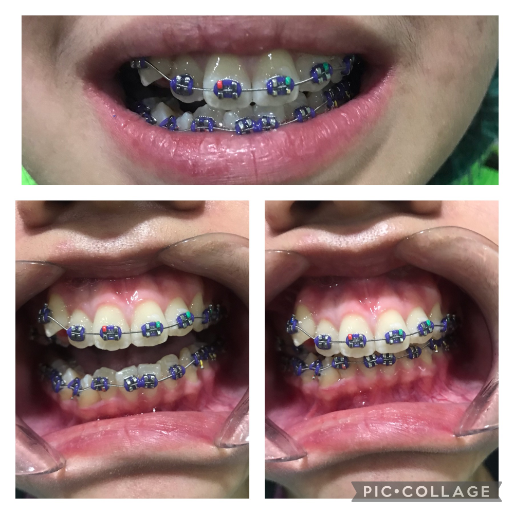 Orthodontics