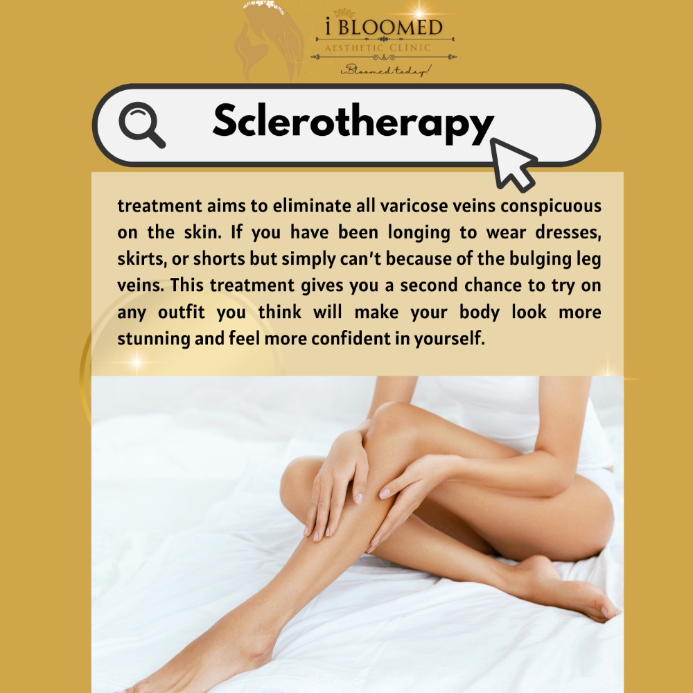 SCLEROTHERAPY