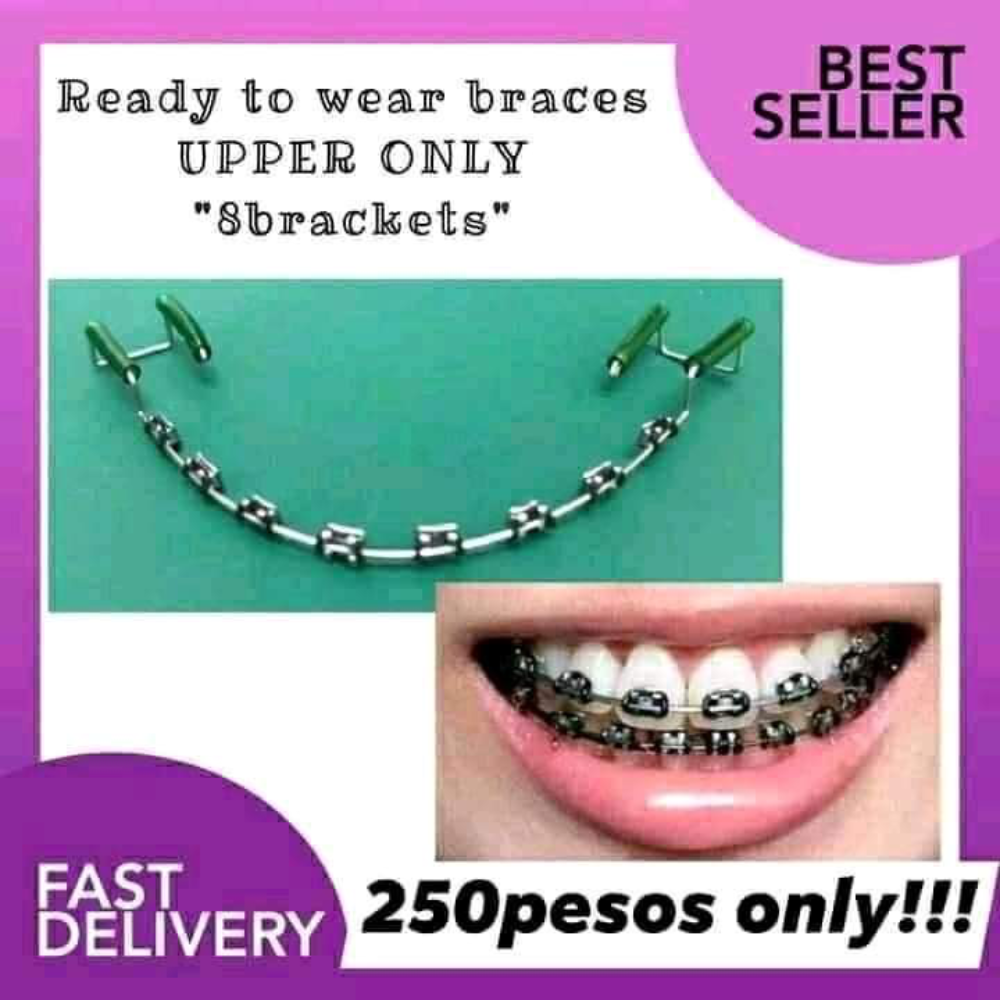 Normal Design Black Ready to Wear Retainer like Braces